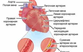 Полезные настойки для сердца