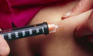 Как правильно делать уколы инсулина?