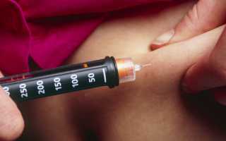 Как правильно делать уколы инсулина?