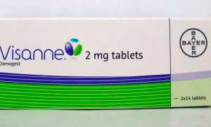 Лечение эндометриоза матки визанной