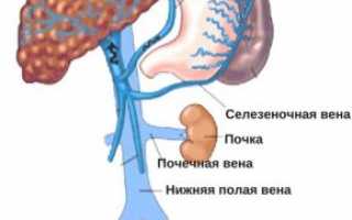 Как помогут крем, гель и мазь при варикозном расширении вен на ногах?