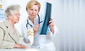 Какой врач лечит остеопороз