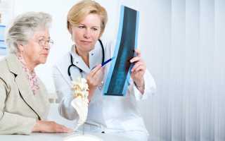 Какой врач лечит остеопороз