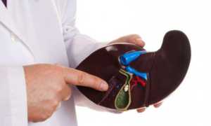 Панкреатит после удаления желчного пузыря