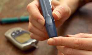 Признаки высокого сахара в крови