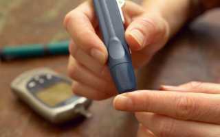 Признаки высокого сахара в крови