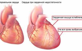 Признаки и варианты лечения слабости сердечной мышцы