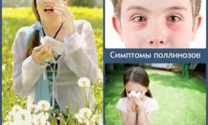 Поллиноз: методы диагностики, принципы лечения и профилактики
