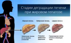 Питание при ожирении печени