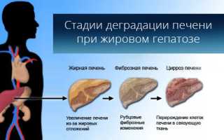 Питание при ожирении печени