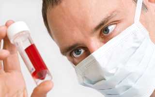 Если скачет сахар в крови