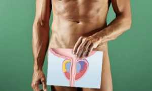 Хронический небактериальный простатит