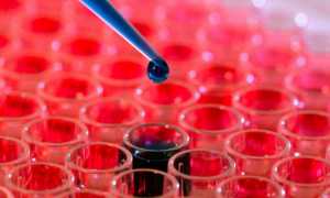 Как правильно сдавать анализ на ТТГ, Т4 и Т3