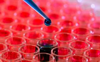 Как правильно сдавать анализ на ТТГ, Т4 и Т3