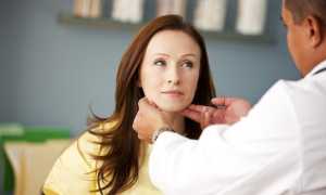 Лечение токсического зоба