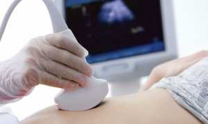 Когда можно делать первое УЗИ при беременности