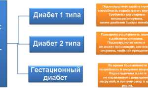 Симптомы диабета у женщин