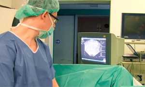 Биопсия предстательной железы