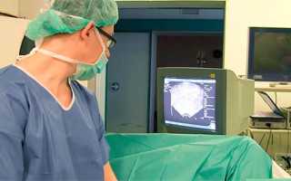 Биопсия предстательной железы