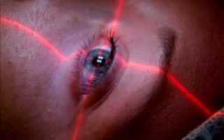 Что такое частичная гетерохромия глаз у людей и опасна ли она для зрения