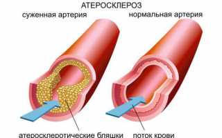 Особенности назначения и применения антиоксидантных препаратов