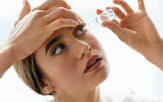 Что такое аллергия глаз: симптомы, причины и способы лечения