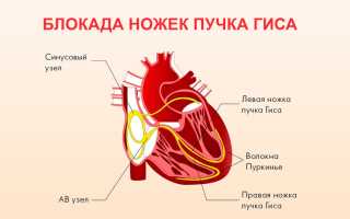 Что означает внутрижелудочковая проводимость сердца