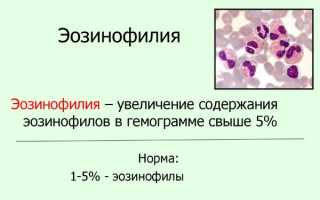 На какие проблемы укажут эозинофилы в крови