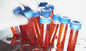 Когда сдавать анализ на антимюллеров гормон?