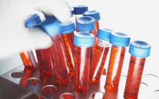 Когда сдавать анализ на антимюллеров гормон?