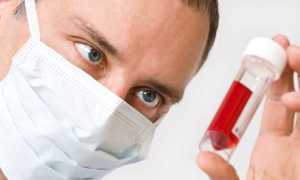 Норма ТТГ после удаления щитовидной железы