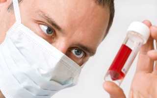 Норма ТТГ после удаления щитовидной железы