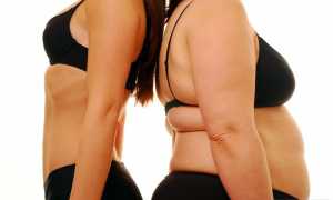 Нарушение обмена веществ у женщин