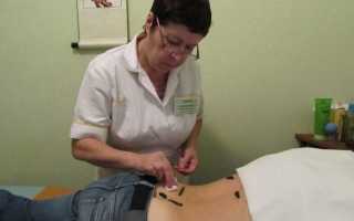 Лечебные пиявки при гипертонии: стоит ли проходить курс?