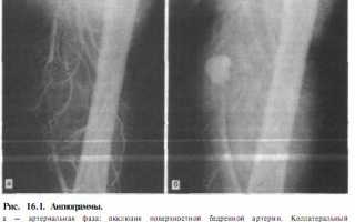 Возникла травма сосудов: когда можно отделаться легким испугом, а когда она несет угрозу для жизни?