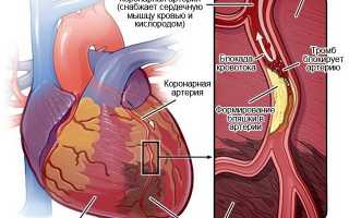 Лекарственное средство Кораксан: применение, эффект