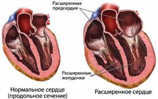 Новые возможности для исследования сердца открывает чреспищеводная эхокардиография