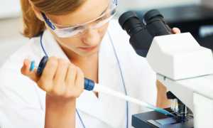 Высокий свободный Т4 при низком ТТГ