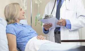 Папиллярная карцинома щитовидки