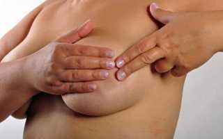 Почему набухают и болят молочные железы?