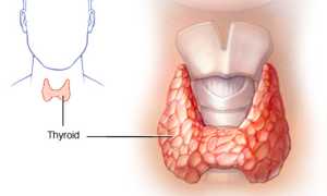 Проблемы с щитовидкой у мужчин
