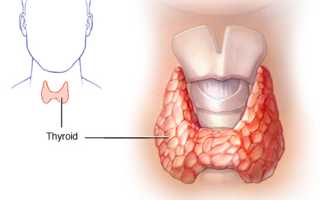 Проблемы с щитовидкой у мужчин
