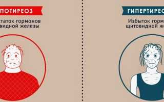 Гипертиреоз и гипотиреоз