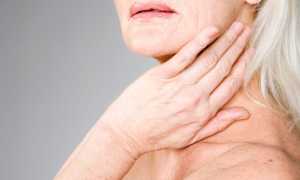 Воспаление слюнных желез