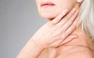 Воспаление слюнных желез