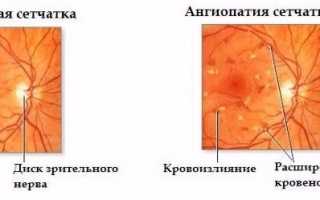 Почему возникает венозный застой в органах и что с этим делать?