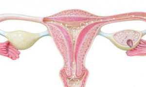 Как рассасывается киста яичника?