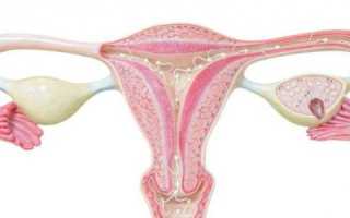 Как рассасывается киста яичника?