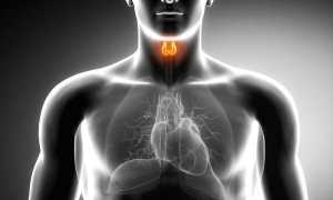 Субклинический тиреотоксикоз