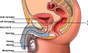 Причины гидроцеле